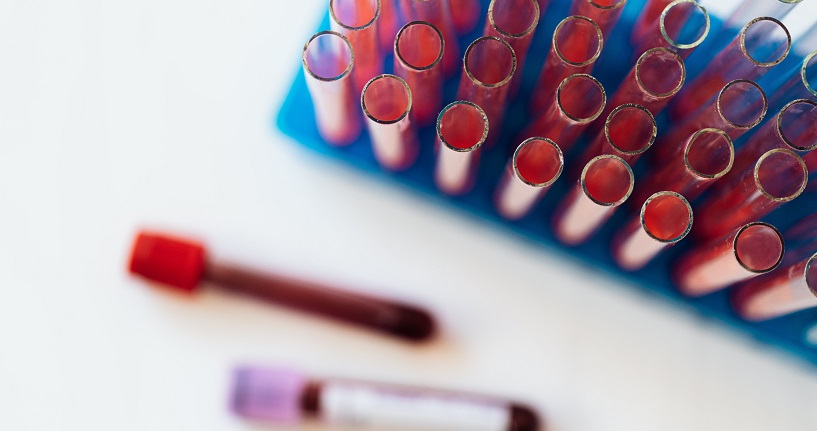 Avances y desafíos en la investigación de la enfermedad de Alzheimer